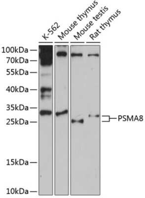 Western Blot: PSMA8 Antibody [NBP2-93338] - Analysis of extracts of various cell lines, using PSMA8 at 1:3000 dilution. Secondary antibody: HRP Goat Anti-Rabbit IgG (H+L) at 1:10000 dilution. Lysates/proteins: 25ug per lane. Blocking buffer: 3% nonfat dry milk in TBST. Detection: ECL Basic Kit . Exposure time: 90s.