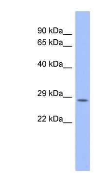 Western Blot: PSMB10 Antibody [NBP1-58937] - Human Placenta lysate, concentration 0.2-1 ug/ml.