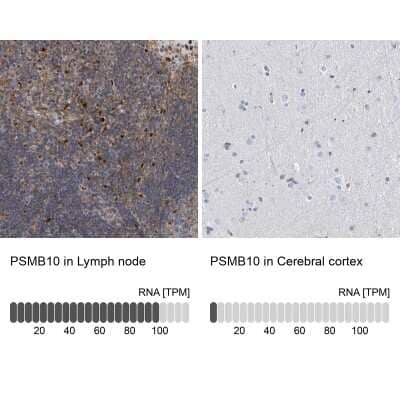 <b>Orthogonal Strategies Validation. </b>Immunohistochemistry-Paraffin: PSMB10/MECL1 Antibody [NBP2-38155] - Staining in human lymph node and cerebral cortex tissues using anti-PSMB10 antibody. Corresponding PSMB10 RNA-seq data are presented for the same tissues.