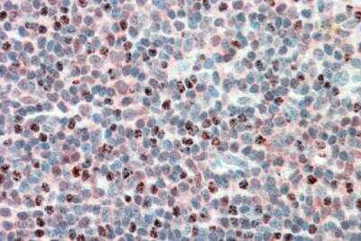 Immunohistochemistry-Paraffin: PSMB10/MECL1 Antibody [NBP1-51958] - Staining of paraffin embedded human tonsil. Antbody at 5 ug/mL. Steamed antigen retrieval with citrate buffer pH 6, AP-staining.