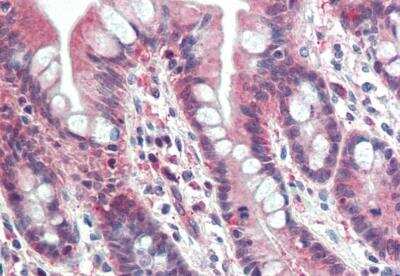 Immunohistochemistry-Paraffin: PSMB10/MECL1 Antibody [NBP1-51958] - Staining of paraffin embedded human small intestine. Antibody at 5 ug/mL. Steamed antigen retrieval with citrate buffer pH 6, AP-staining.