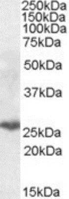 Western Blot PSMB10/MECL1 Antibody