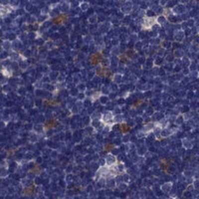 Immunohistochemistry-Paraffin: PSMB11 Antibody [NBP2-68605] - Staining of human thymus shows strong cytoplasmic positivity in cortical cells.