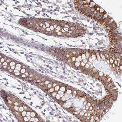 Immunohistochemistry-Paraffin: PSMB11 Antibody [NBP2-34158] - Staining of human colon shows strong cytoplasmic positivity in glandular cells.