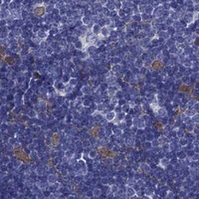 Immunohistochemistry-Paraffin PSMB11 Antibody