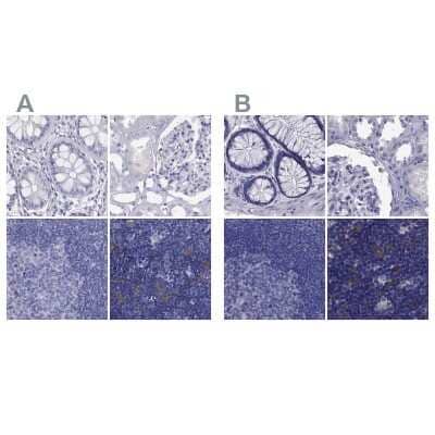 Immunohistochemistry-Paraffin PSMB11 Antibody