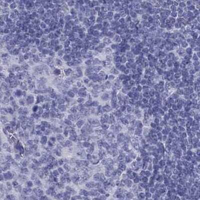 Immunohistochemistry-Paraffin PSMB11 Antibody