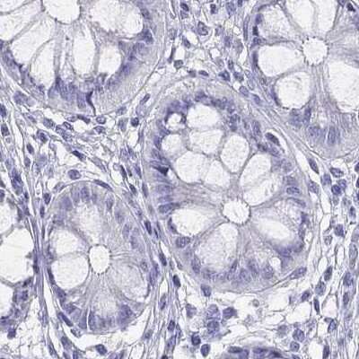 Immunohistochemistry-Paraffin: PSMB11 Antibody [NBP2-34158] - Staining of human colon.