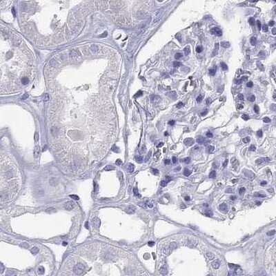 Immunohistochemistry-Paraffin: PSMB11 Antibody [NBP2-34158] - Staining of human kidney.