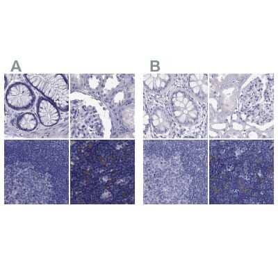 Immunohistochemistry-Paraffin: PSMB11 Antibody [NBP2-68605] - Staining of human colon, kidney, lymph node and thymus using Anti-PSMB11 antibody NBP2-68605 (A) shows similar protein distribution across tissues to independent antibody NBP2-34158 (B).