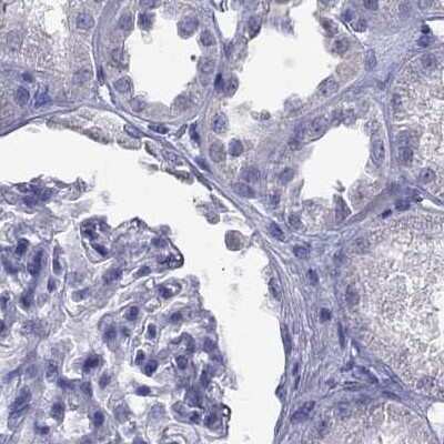 Immunohistochemistry-Paraffin: PSMB11 Antibody [NBP2-68605] - Staining of human kidney.