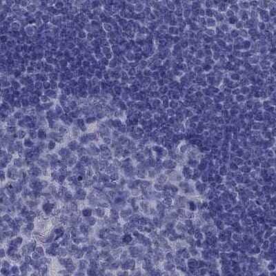 Immunohistochemistry-Paraffin: PSMB11 Antibody [NBP2-68605] - Staining of human lymph node.