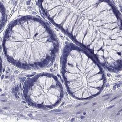 <b>Independent Antibodies Validation. </b>Immunohistochemistry-Paraffin: PSMB11 Antibody [NBP2-68605] - Staining of human colon.