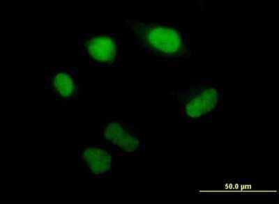 Immunocytochemistry/Immunofluorescence: PSMB5 Antibody [H00005693-B02P] - Analysis of purified antibody to PSMB5 on HeLa cell. (antibody concentration 10 ug/ml)