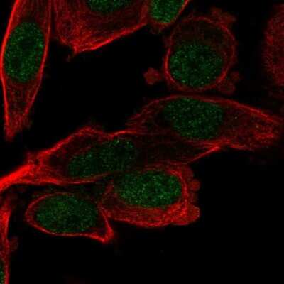 Immunocytochemistry/Immunofluorescence: PSMB5 Antibody [NBP2-13820] - Staining of human cell line PC-3 shows localization to nucleoplasm. Antibody staining is shown in green.