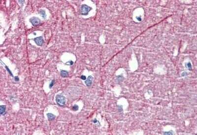 Immunohistochemistry-Paraffin: PSMB5 Antibody [NBP1-52476] - Analysis of anti-PSMB5 antibody with human brain, cortex at concentration 3.75 ug/ml.