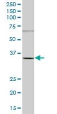 Western Blot: PSMB5 Antibody [H00005693-B02P] - Analysis of PSMB5 expression in human liver.