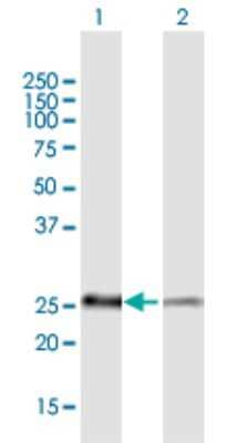 Western Blot: PSMB5 Antibody [H00005693-B02P] - Analysis of PSMB5 expression in transfected 293T cell line by PSMB5 polyclonal antibody.  Lane 1: PSMB5 transfected lysate(28.93 KDa). Lane 2: Non-transfected lysate.