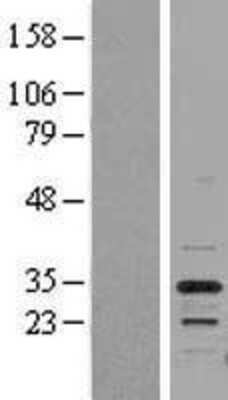 Western Blot: PSMB5 Overexpression Lysate (Adult Normal) [NBL1-14880] Left-Empty vector transfected control cell lysate (HEK293 cell lysate); Right -Over-expression Lysate for PSMB5.