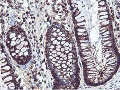 Immunohistochemistry: PSMB7 Antibody (OTI1E1) - Azide and BSA Free [NBP2-73645] - Staining of paraffin-embedded Human colon tissue using anti-Proteasome 20S beta 7 mouse monoclonal antibody.