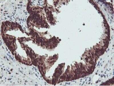 Immunohistochemistry: PSMB7 Antibody (OTI1E1) - Azide and BSA Free [NBP2-73645] - Staining of paraffin-embedded Human prostate tissue using anti-Proteasome 20S beta 7 mouse monoclonal antibody.