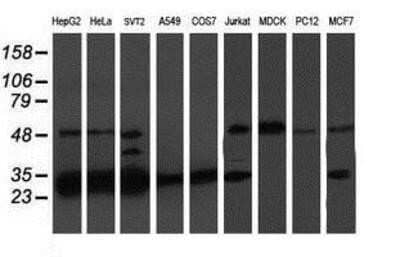 Western Blot: PSMB7 Antibody (OTI1E1) - Azide and BSA Free [NBP2-73645] - Analysis of extracts (35ug) from 9 different cell lines by using anti-Proteasome 20S beta 7 monoclonal antibody.