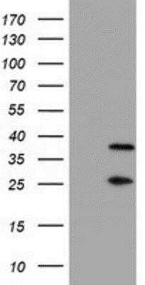 Western Blot: PSMB7 Antibody (OTI1E1) - Azide and BSA Free [NBP2-73645] - HEK293T cells were transfected with the pCMV6-ENTRY control (Left lane) or pCMV6-ENTRY Proteasome 20S beta 7 (Right lane) cDNA for 48 hrs and lysed. Equivalent amounts of cell lysates (5 ug per lane) were separated by SDS-PAGE and immunoblotted with anti