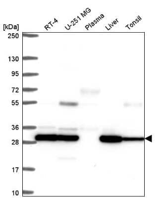 Western Blot: PSMB7 Antibody [NBP2-58648] - Western blot analysis in human cell line RT-4, human cell line U-251 MG, human plasma, human liver tissue and human tonsil tissue.