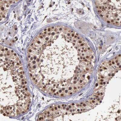 Immunohistochemistry-Paraffin: PSMC1 Antibody [NBP1-80959] - Staining of human testis shows strong nuclear positivity in cells in seminiferous ducts.