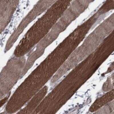 Immunohistochemistry-Paraffin: PSMC1 Antibody [NBP3-17916] - Staining of human skeletal muscle shows strong cytoplasmic positivity in myocytes.