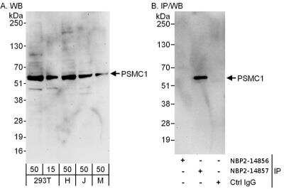 Western Blot: PSMC1 Antibody [NBP2-14856] - Samples: Whole cell lysate from 293T (15 and 50 ug for WB; 1 mg for IP, 20% of IP loaded), HeLa (H; 50 ug), Jurkat (J; 50 ug) and mouse NIH3T3 (M; 50 ug) cells. Antibodies: Affinity purified rabbit anti-PSMC1 antibody used for WB at 0.4 ug/ml (A) and 1 ug/ml (B) and used for IP at 6 ug/mg lysate. PSMC1 was successfully immunoprecipitated by rabbit anti-PSMC1 antibody , which recognizes a downstream epitope. Detection: Chemiluminescence with exposure times of 3 minutes (A) and 30 seconds (B).