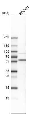 Western Blot: PSMC1 Antibody [NBP1-80959] - Analysis in human cell line EFO-21.