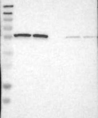 Western Blot: PSMC1 Antibody [NBP3-17916] - Lane 1: Marker [kDa] 230, 130, 95, 72, 56, 36, 28, 17, 11;   Lane 2: RT4;   Lane 3: U-251 MG;   Lane 4: Human Plasma;   Lane 5: Liver;   Lane 6: Tonsil