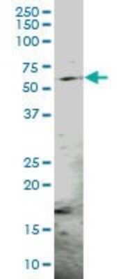 Western Blot: PSMC3 Antibody [H00005702-B01P] - Analysis of PSMC3 expression in rat brain.