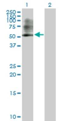 Western Blot: PSMC3 Antibody [H00005702-D01P] - Analysis of PSMC3 expression in transfected 293T cell line by PSMC3 polyclonal antibody.Lane 1: PSMC3 transfected lysate(49.20 KDa).Lane 2: Non-transfected lysate.