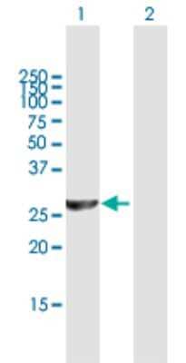 Western Blot: PSMC3IP Antibody [H00029893-B01P] - Analysis of PSMC3IP expression in transfected 293T cell line by PSMC3IP polyclonal antibody.  Lane 1: TBPIP transfected lysate(23.87 KDa). Lane 2: Non-transfected lysate.