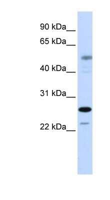 Western Blot: PSMC3IP Antibody [NBP1-79238] - 721_B cell lysate, concentration 0.2-1 ug/ml.