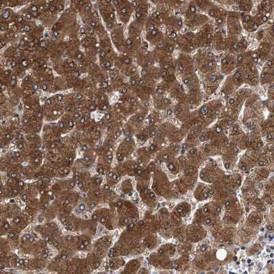 Immunohistochemistry-Paraffin: PSMD12 Antibody [NBP1-87801] - Staining of human liver shows distinct cytoplasmic positivity in hepatocytes.