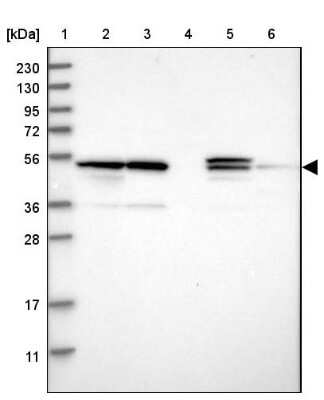 Western Blot: PSMD12 Antibody [NBP1-87801] - Lane 1: Marker  [kDa] 230, 130, 95, 72, 56, 36, 28, 17, 11.  Lane 2: Human cell line RT-4.  Lane 3: Human cell line U-251MG sp.  Lane 4: Human plasma (IgG/HSA depleted).  Lane 5: Human liver tissue.  Lane 6: Human tonsil tissue