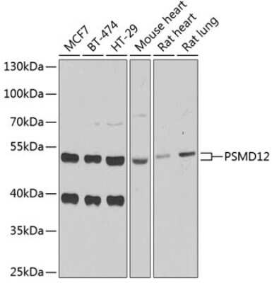 Western Blot: PSMD12 Antibody [NBP2-94102] - Analysis of extracts of various cell lines, using PSMD12 at 1:1000 dilution. Secondary antibody: HRP Goat Anti-Rabbit IgG (H+L) at 1:10000 dilution. Lysates/proteins: 25ug per lane. Blocking buffer: 3% nonfat dry milk in TBST. Detection: ECL Basic Kit . Exposure time: 90s.