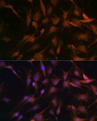 Immunocytochemistry/Immunofluorescence: PSMD13 Antibody [NBP2-95231] - Analysis of C6 cells using PSMD13 . Blue: DAPI for nuclear staining.