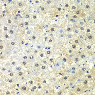 Immunohistochemistry-Paraffin: PSMD13 Antibody [NBP2-95231] - Paraffin-embedded human liver damage using PSMD13 .