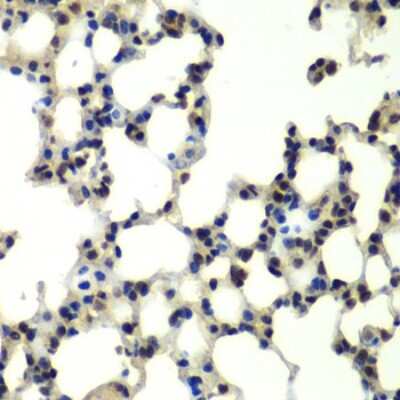 Immunohistochemistry-Paraffin: PSMD13 Antibody [NBP2-95231] - Paraffin-embedded mouse lung using PSMD13 .