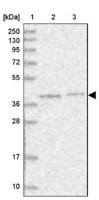 Western Blot: PSMD13 Antibody [NBP1-80961] - Lane 1: Marker [kDa] 250, 130, 95, 72, 55, 36, 28, 17, 10Lane 2: Human cell line RT-4Lane 3: Human cell line U-251MG sp