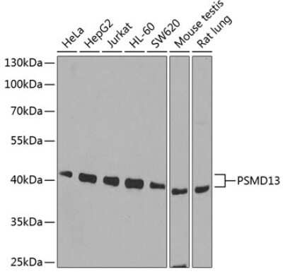 Western Blot: PSMD13 Antibody [NBP2-95231] - Analysis of extracts of various cell lines, using PSMD13 at 1:1000 dilution. Secondary antibody: HRP Goat Anti-Rabbit IgG (H+L) at 1:10000 dilution. Lysates/proteins: 25ug per lane. Blocking buffer: 3% nonfat dry milk in TBST. Detection: ECL Basic Kit . Exposure time: 90s.
