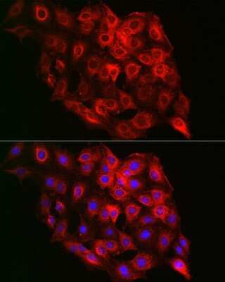 Immunocytochemistry/Immunofluorescence: PSMD8 Antibody [NBP2-95230] - Immunofluorescence analysis of C6 cells using PSMD8 Rabbit pAb (NBP2-95230) at dilution of 1:100 (40x lens). Blue: DAPI for nuclear staining.