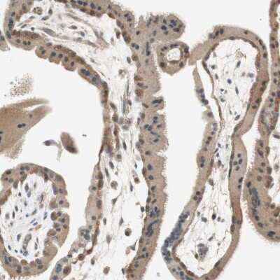 Immunohistochemistry-Paraffin: PSMD8 Antibody [NBP1-83254] - Staining of human placenta shows moderate cytoplasmic positivity in trophoblastic cells.