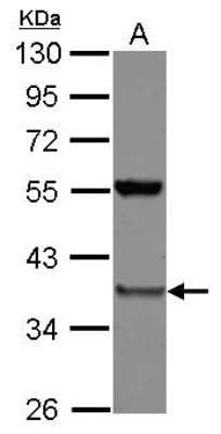 Western Blot: PSMD8 Antibody [NBP2-19989] - Sample (30 ug of whole cell lysate) A: A549 10% SDS PAGE gel, diluted at 1:1000.