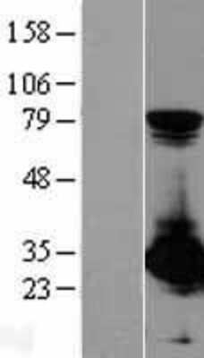 Western Blot: PSME1 Overexpression Lysate (Adult Normal) [NBL1-14907] Left-Empty vector transfected control cell lysate (HEK293 cell lysate); Right -Over-expression Lysate for PSME1.