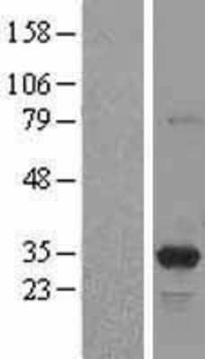 Western Blot PA28 Activator gamma Subunit/PSME3 Overexpression Lysate